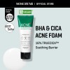 SOME BY MI AHA BHA PHA 30 Days Miracle - Espuma transparente para el acné, 3.38 onzas, 3.4 fl oz, hecha de agua de hojas de