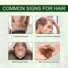 Aceite esencial de romero para el crecimiento del cabello, aceite de romero orgánico 100% puro para cejas y pestañas, nutre el