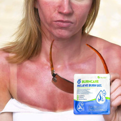 Kit de quemaduras | Gel calmante para todo tipo de quemaduras en la piel