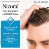 Nizoral Champú anticaspa con 1% de ketoconazol, aroma fresco, 14 onzas líquidas (paquete de 2)