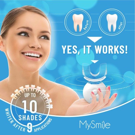 Kit de blanqueamiento de dientes MySmile con luz LED, blanqueador rápido para no sensibles dientes en 10 minutos con 3 gel