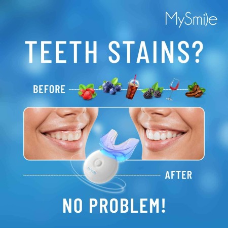 Kit de blanqueamiento de dientes MySmile con luz LED, blanqueador rápido para no sensibles dientes en 10 minutos con 3 gel